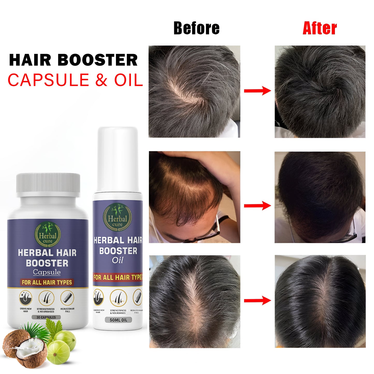 Combo of Herbal Hair Booster Oil and Capsule-For Men and Women
