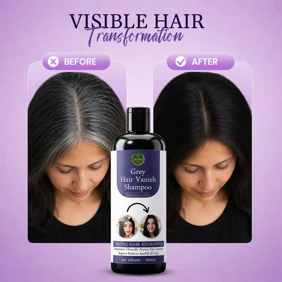 Grey Hair Vanish Shampoo – Natural Grey Hair Care & Hair Growth Support