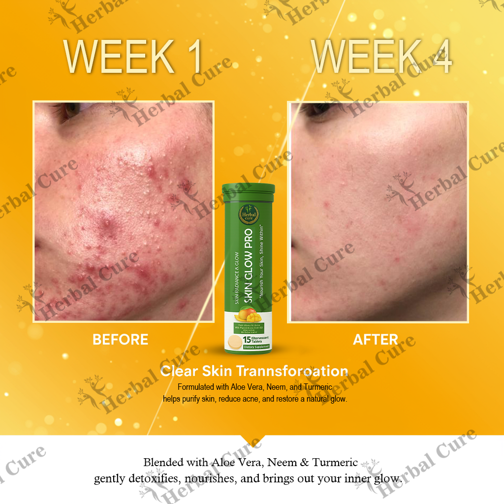 Herbal Skin Glow Pro Tablet for Men & Women (Pack-of- 2- 30 Tablets)