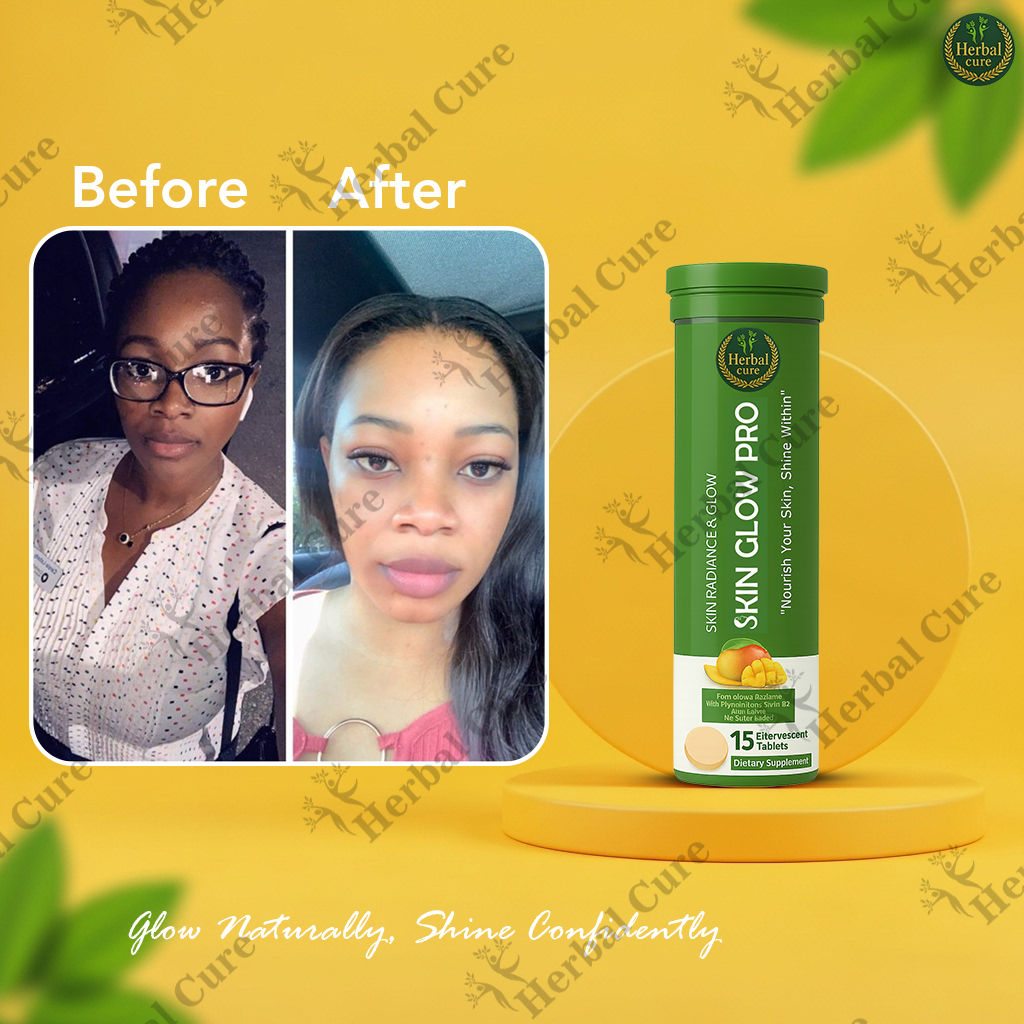 Herbal Skin Glow Pro Tablet for Men & Women (Pack-of- 2- 30 Tablets)