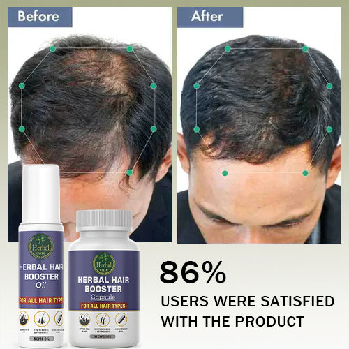 Combo of Herbal Hair Booster Oil and Capsule-For Men and Women