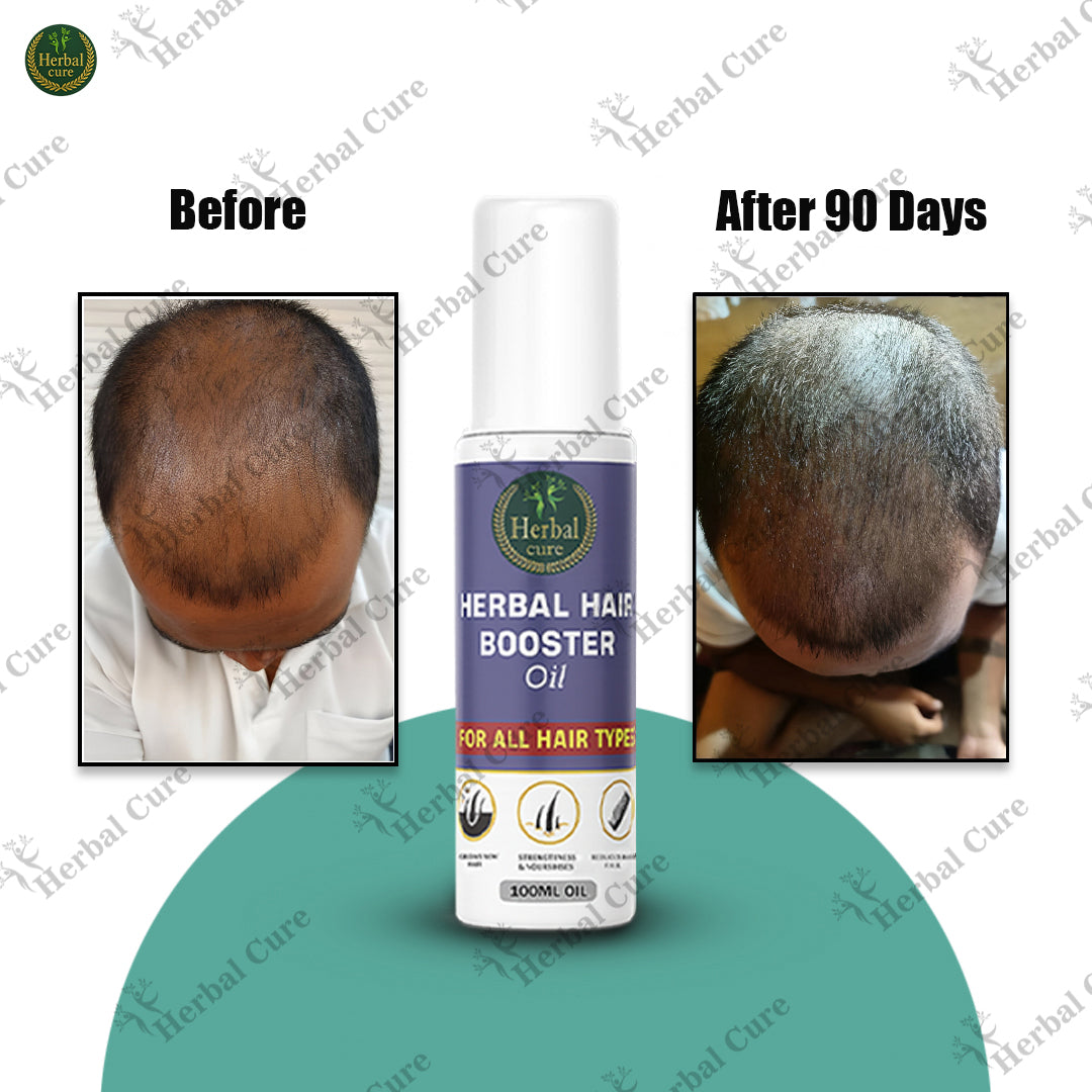 Herbal Hair Booster Oil-For Men and Women