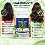 Herbal Hair Booster Capsule For Men And Women