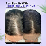 Herbal Hair Booster Oil- Suitable For Men and Women 100 ML